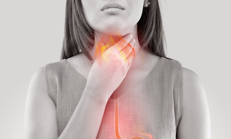 Trào ngược dạ dày lâu năm có thể gây biến chứng! 1