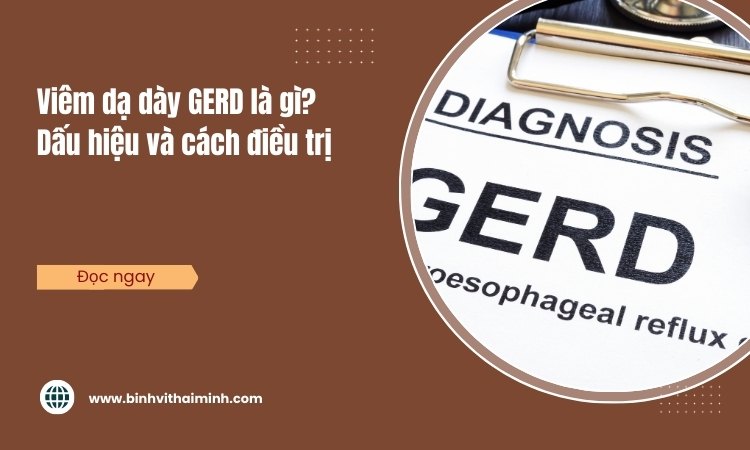 Viêm dạ dày GERD là gì? dấu hiệu và cách điều trị!