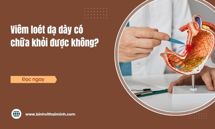 Viêm loét dạ dày có chữa khỏi được không?