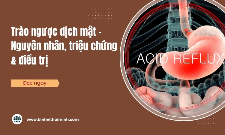 Trào ngược dịch mật – Nguyên nhân, triệu chứng & điều trị