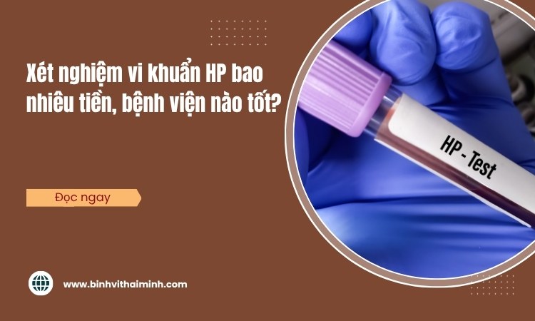 Xét nghiệm vi khuẩn HP bao nhiêu tiền, ở bệnh viện nào tốt?