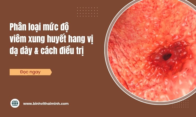 Phân loại mức độ viêm xung huyết hang vị dạ dày & cách điều trị