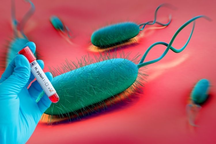 5. Kháng sinh diệt Helicobacter Pylori (HP) 1