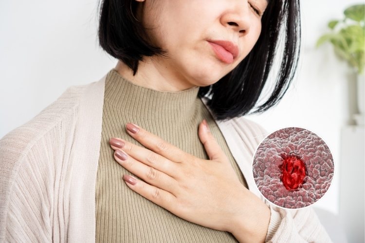 Viêm loét dạ dày gây khó thở có gây nguy hiểm không? 1