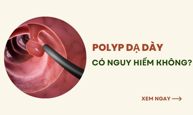 polyp dạ dày có nguy hiểm không