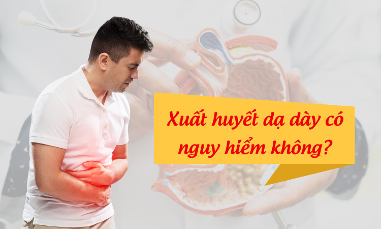 [Giải đáp]: Xuất huyết dạ dày có nguy hiểm không?