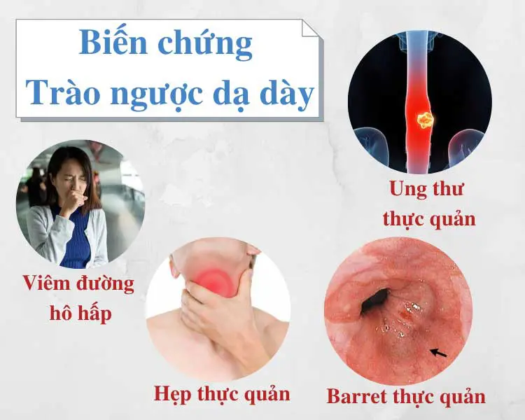 bien-chung-trao-nguoc-da-day-thuc-quan.jpg