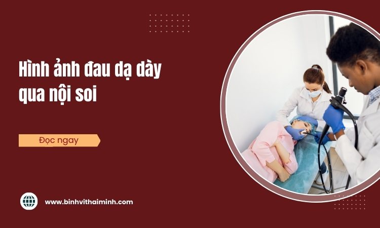 Hình ảnh đau dạ dày qua nội soi