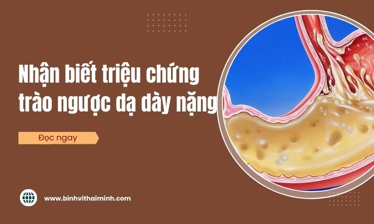 Triệu chứng trào ngược dạ dày nặng bạn phải biết! 1